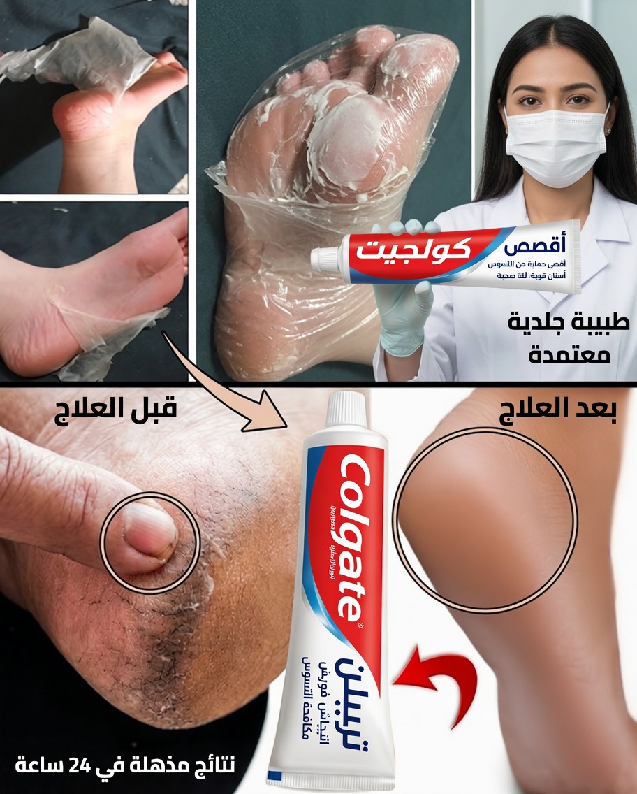 سرّ كولجيت للعناية بالقدمين: حيلة بسيطة لقدمين أكثر نعومة وصحة