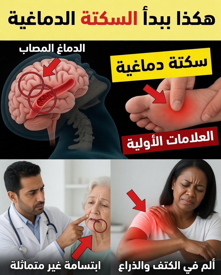 8 علامات تحذيرية للسكتة الدماغية قد تلاحظها قبل فوات الأوان