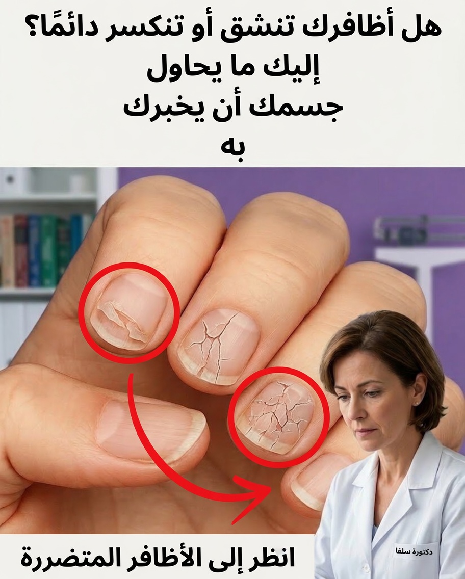 7 علامات صحية خفية تحاول أظافرك كشفها