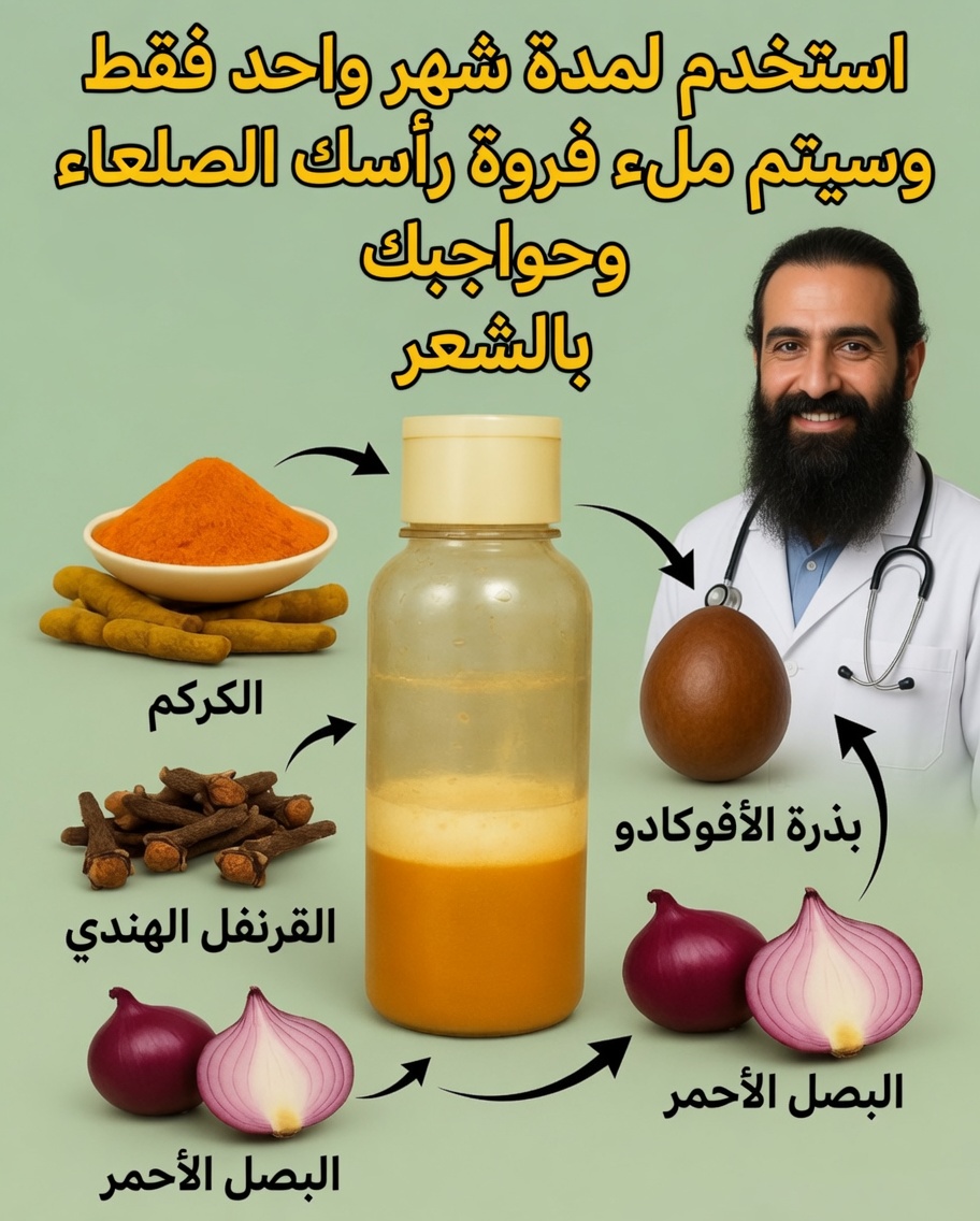وصفة الشامبو المعجزة: الكركم والقرنفل والبصل وبذور الأفوكادو