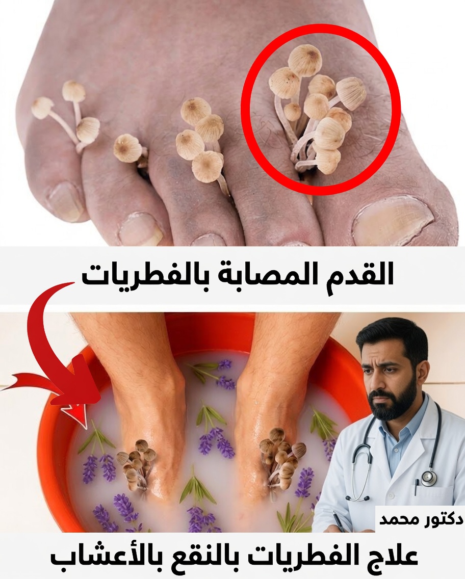 نقع ملح إبسوم لمدة 5 دقائق: علاج طبيعي بسيط لتقليل الالتهاب والفطريات والألم والمزيد