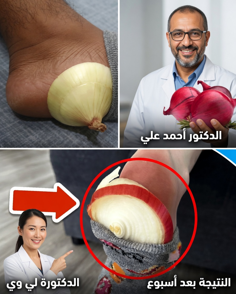 البصل في الجوارب: علاج طبيعي بسيط بشكل مدهش لتخفيف أعراض نزلات البرد والإنفلونزا