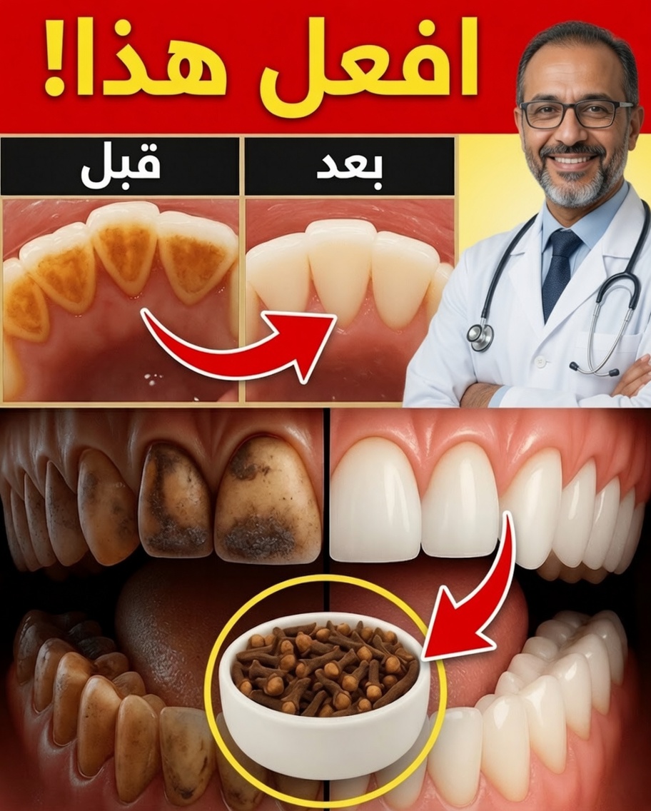 9 علاجات منزلية مثبتة لإزالة البلاك والجير طبيعيًا