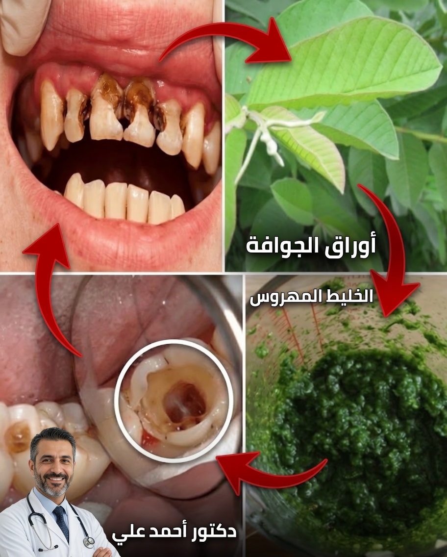 أوراق الجوافة لابتسامة مشرقة: سر العناية الطبيعية بالفم المتوارث عن جدة تبلغ من العمر 70 عامًا
