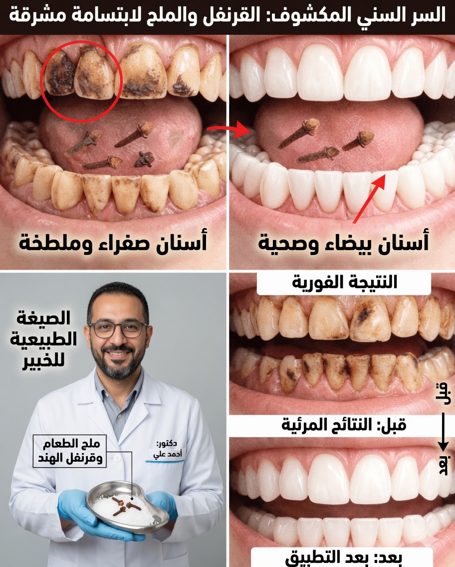9 طرق طبيعية للمساعدة على تقليل اللويحة السنية والجير – استراتيجيات لطيفة في المنزل لابتسامة أكثر إشراقًا