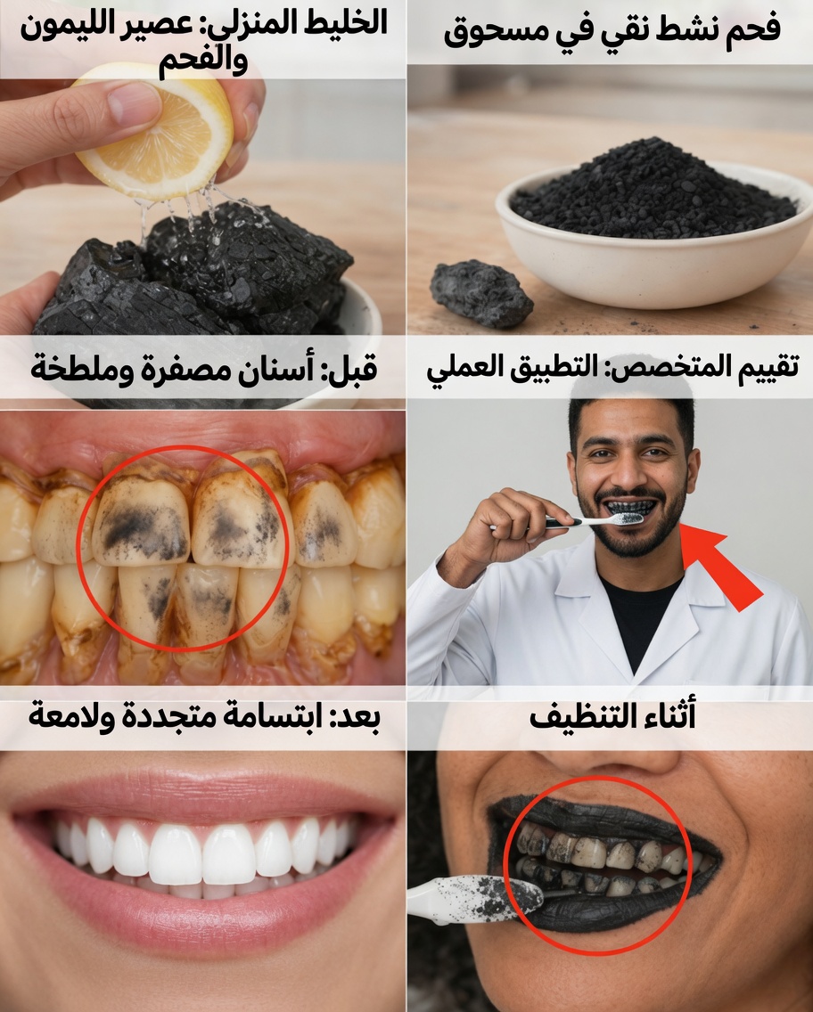 كيفية تبييض الأسنان بأمان: الحقيقة حول الفحم والليمون (وما الذي ينجح حقًا)