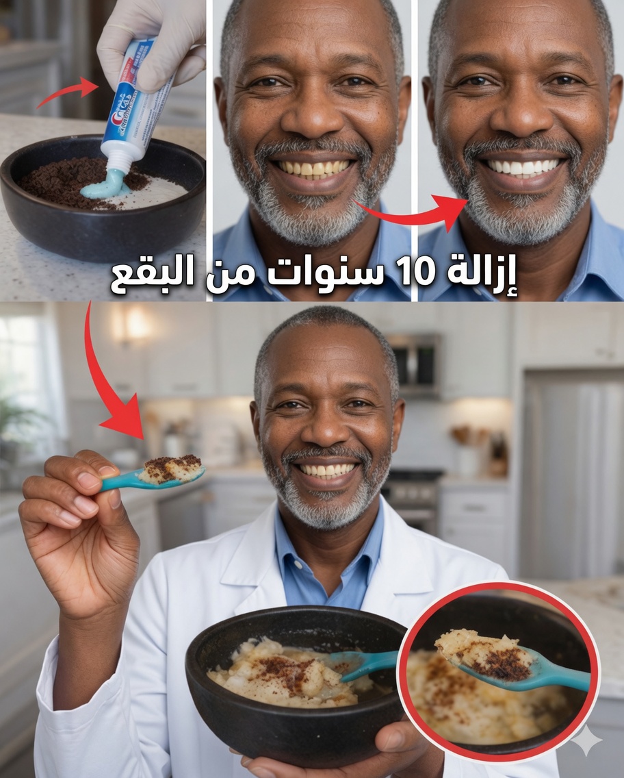 أزل ما يصل إلى 10 سنوات من بقع الأسنان في دقيقتين فقط – المُبيِّض الطبيعي الذي يلفت الانتباه